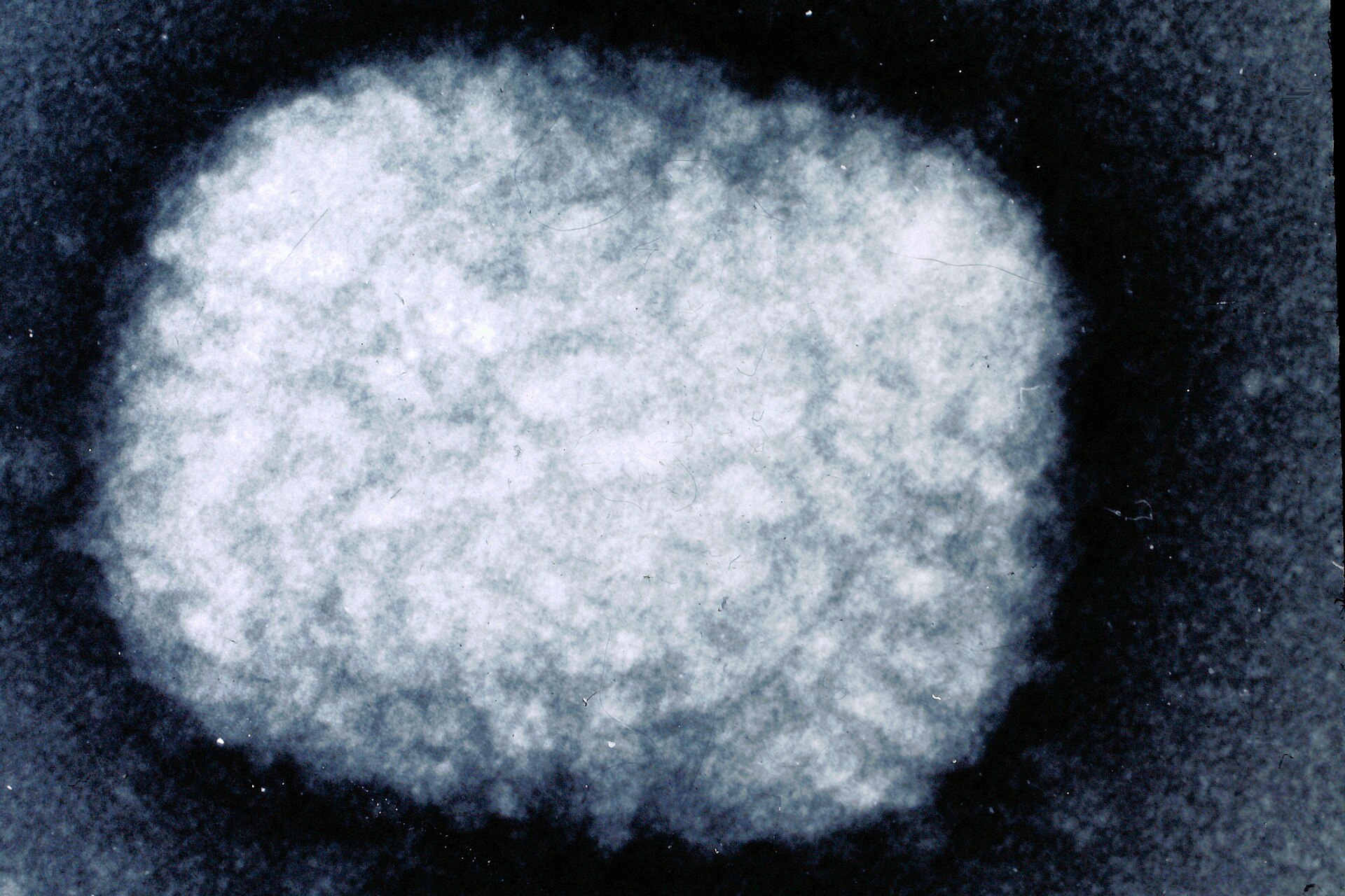 Smallpox Declared Eradicated by WHO